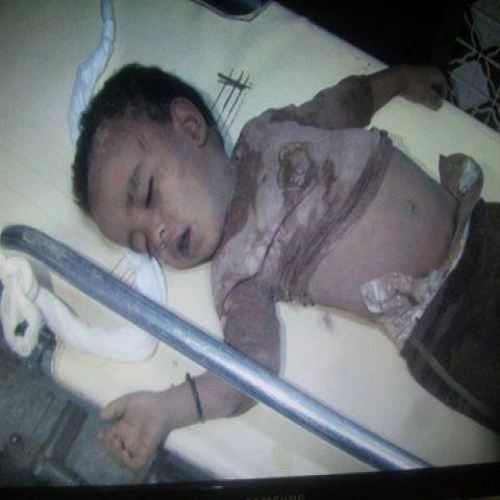 السعودية من ضرب أنصار الله إلي استهداف أطفال اليمن
